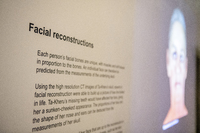 Facial reconstruction text